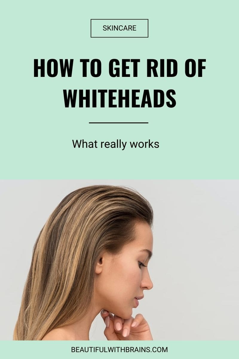 prevent and get rid of whiteheads